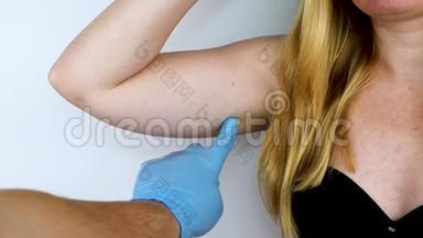 一位整形外科医生正准备收紧手部皮肤。 腕管成形术-塑料手臂，手上挂着皮肤